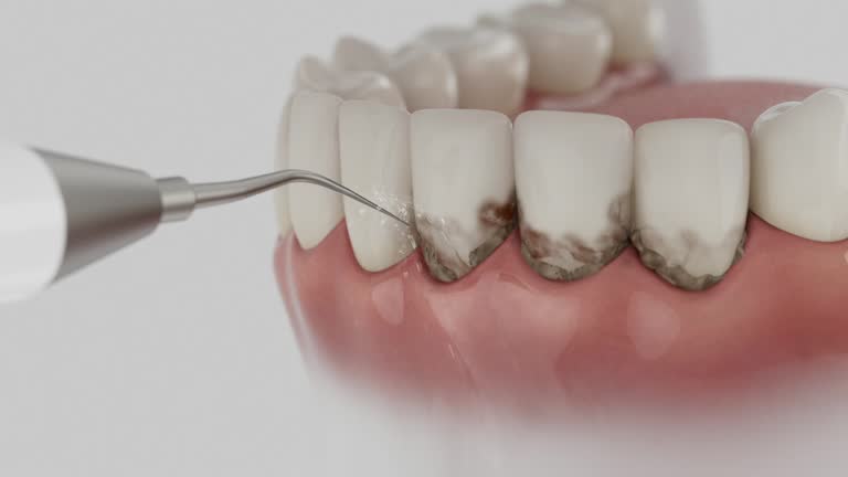 Trusted Root Canal Treatment service in Wheelersburg, OH - Dentist Open Now